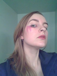 10pm - I haven't been able to wear eye makeup for about a month now waiting for my eyes to heal. I had a breakdown and decided to see what it would look like if I wore makeup on only the more healed eye... (this is what happens when there's no one around and I feel unselfconcious..)